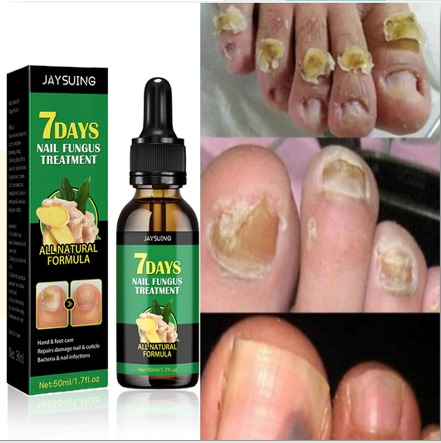 ACEITE DE JENGIBRE PARA UÑAS